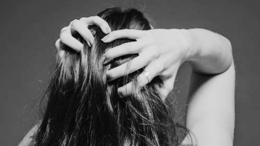 Pellicules et cuir chevelu irrité : solutions efficaces